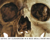 Classroom in a Box: Skull kit